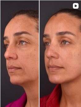Capa de publicação com duas fotografias de perfil facial